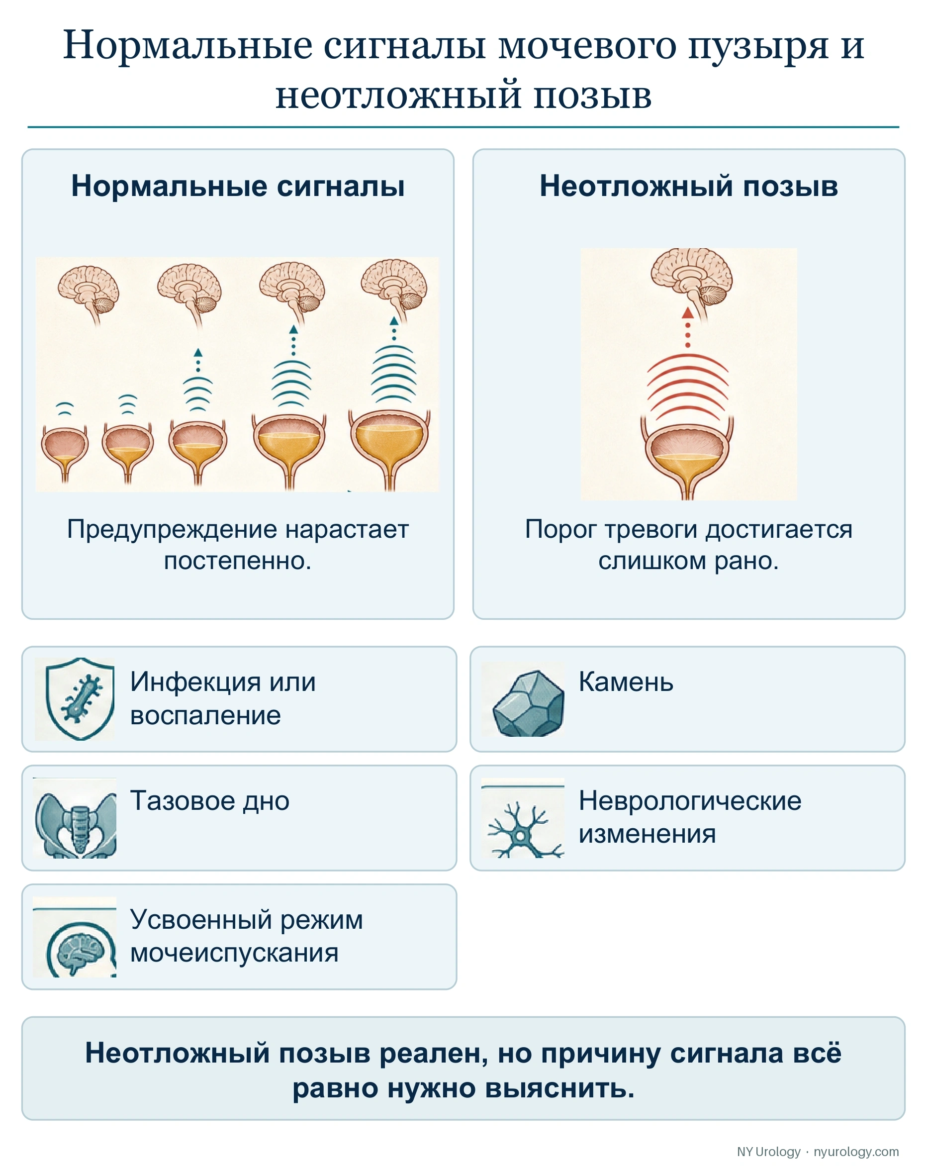 Нормальные сигналы мочевого пузыря и неотложный позыв